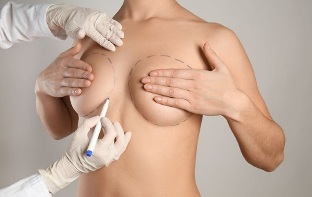métodos de aumento mamario con cirurxía