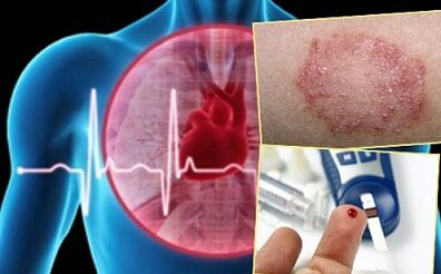 Contraindicacións para o lipolifting