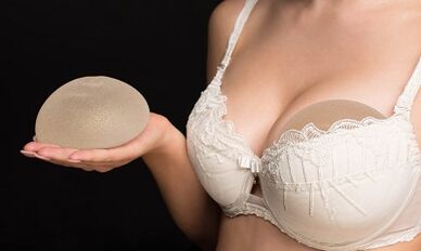 Indicios para a ampliación de mama con implantes